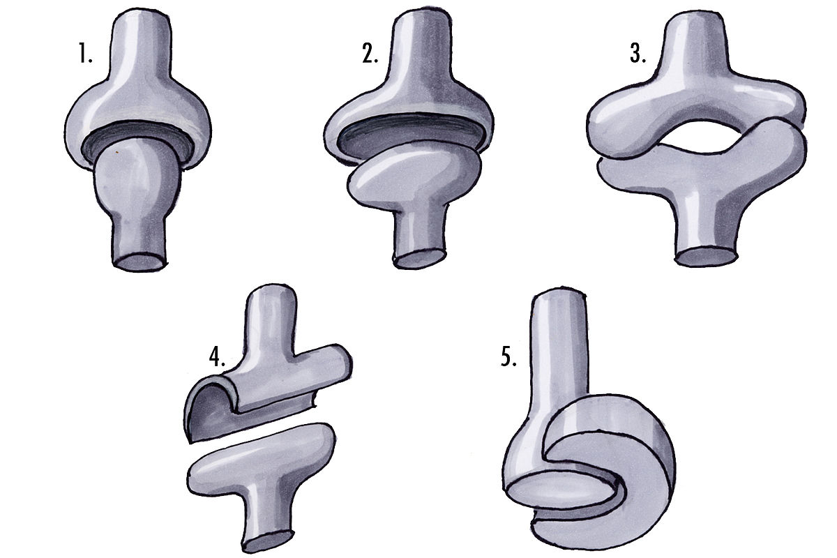 condyloid-joint-definition-and-examples-biology-online-dictionary