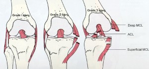 acl and mcl diagram