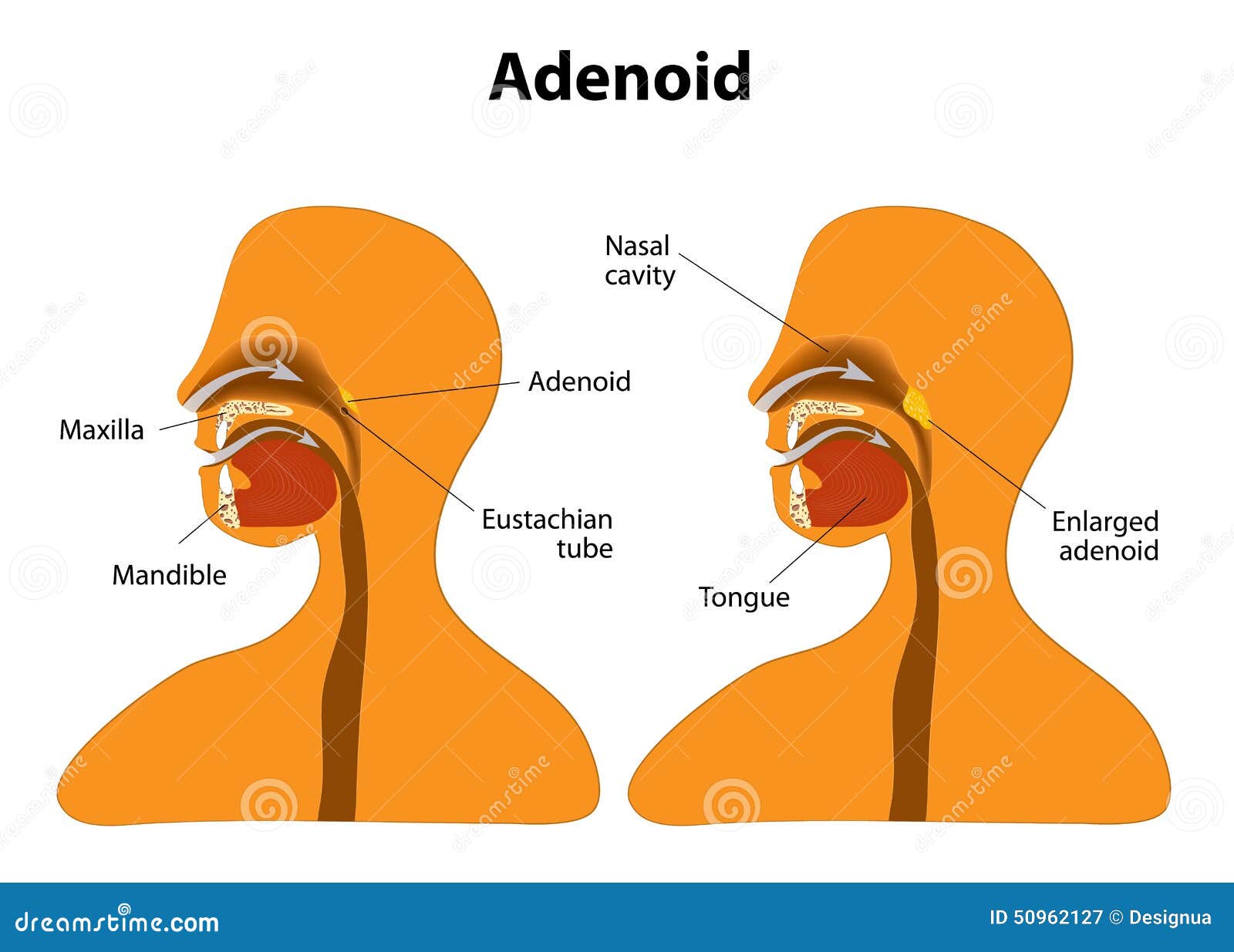 adenoids diagram