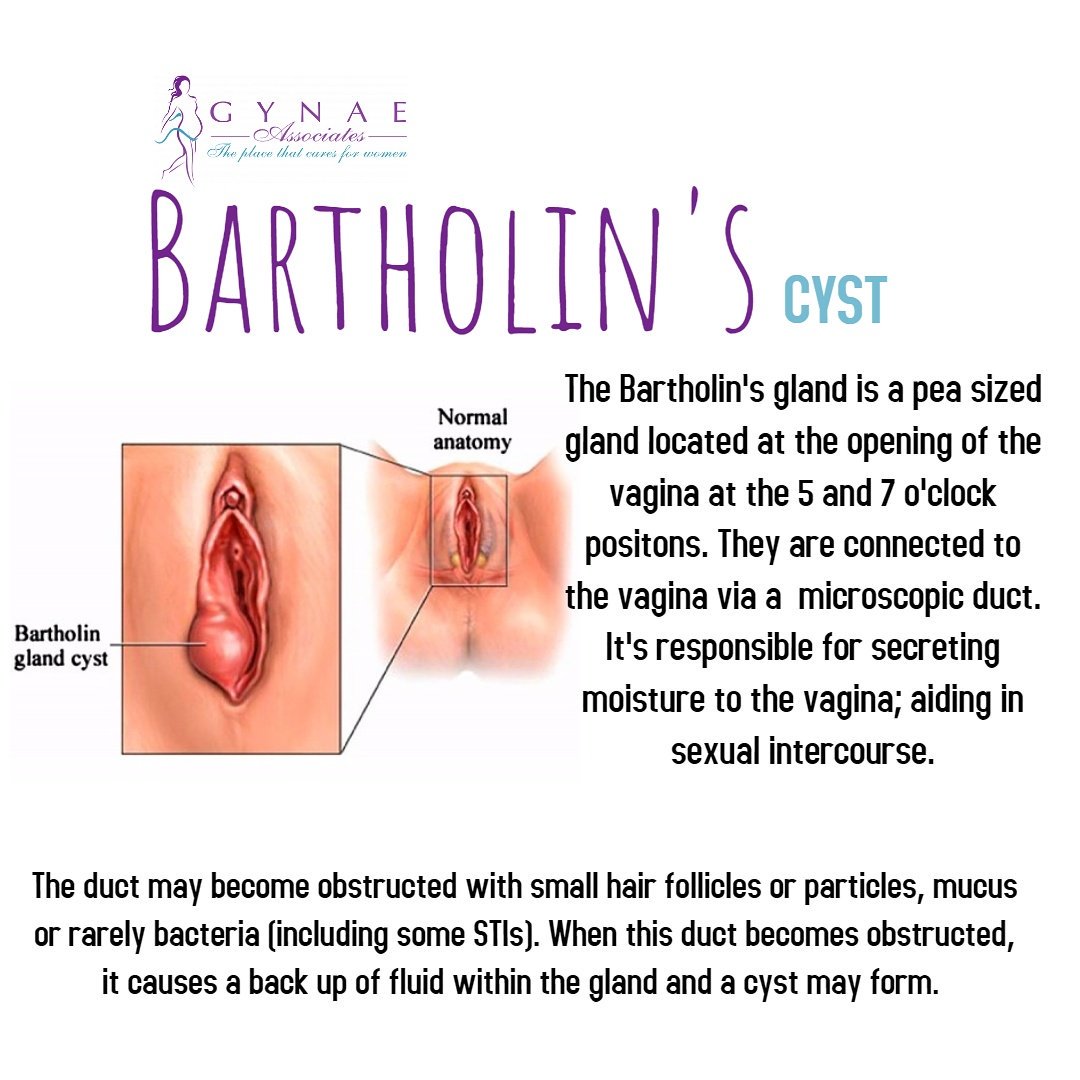 bartholin gland diagram