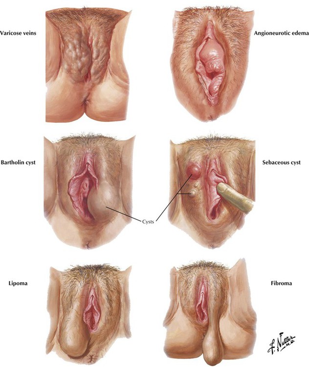 bartholin gland diagram