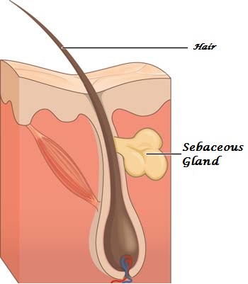 blind pimple diagram