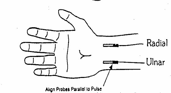 bob beck blood electrifier circuit diagram