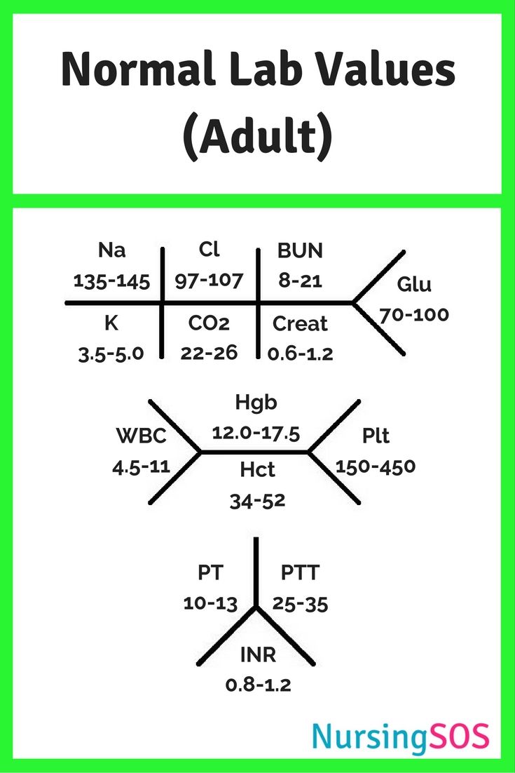 cmp fishbone diagram