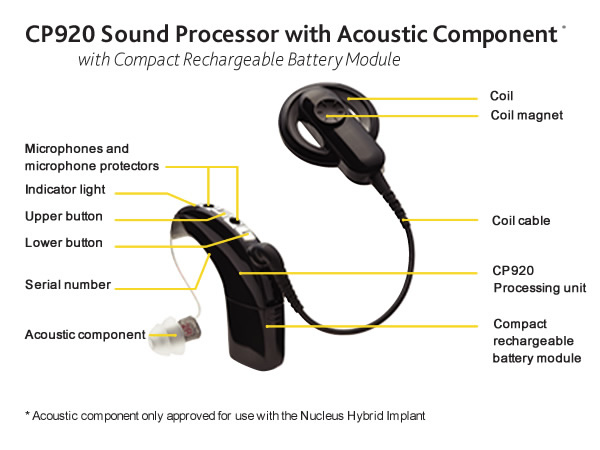 cochlear implant parts diagram