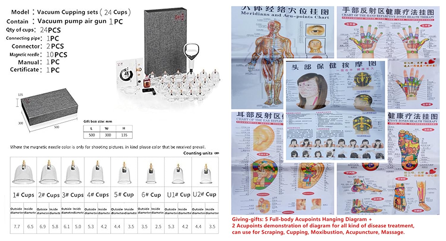 cupping-points-diagram