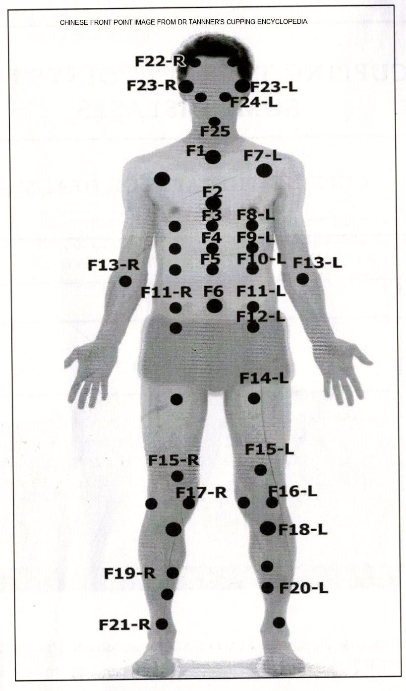 cupping points diagram