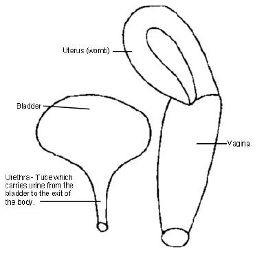 cystocele diagram