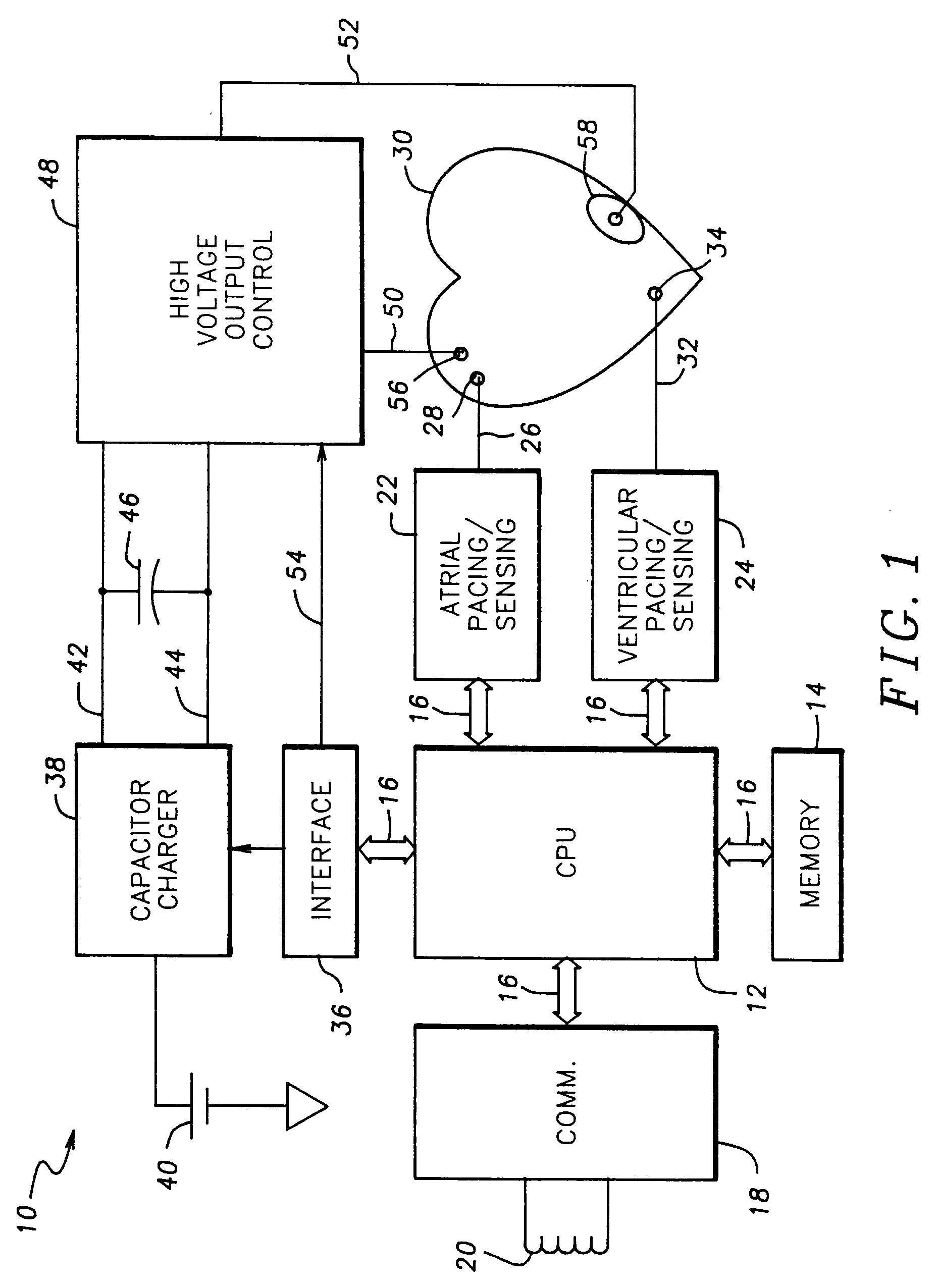 defibrillator circuit diagram