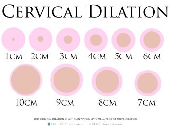 diagram of cervical dilation