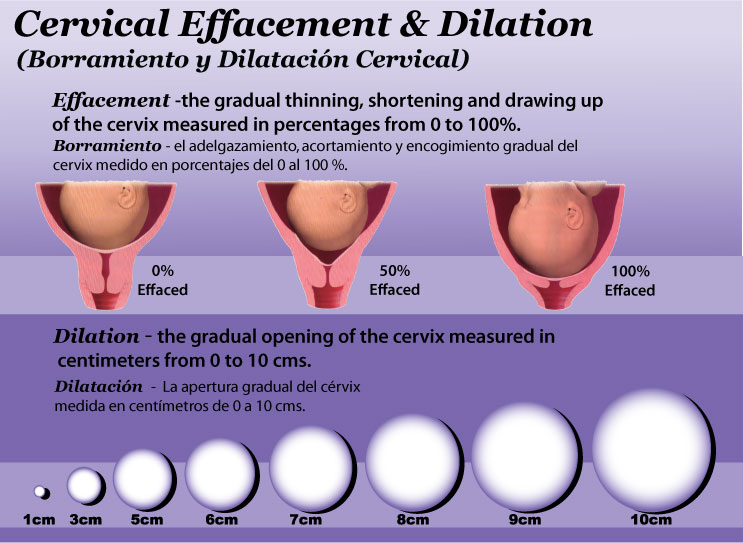 diagram of cervical dilation