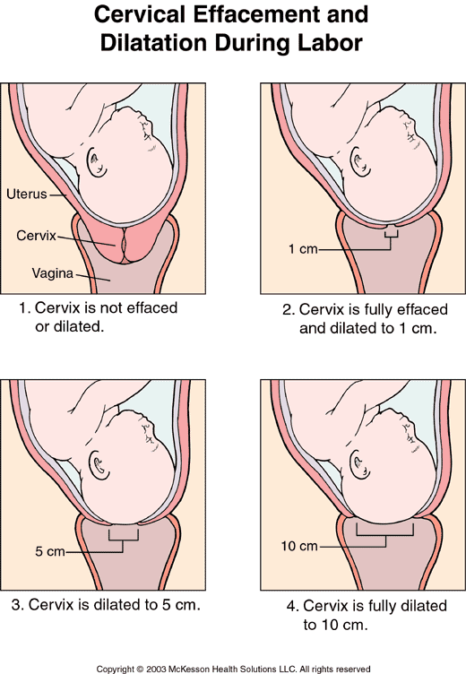 diagram of cervical dilation