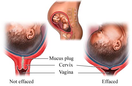 diagram of cervical dilation
