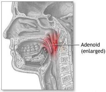 diagram of tonsils and adenoids