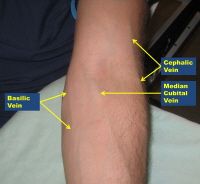 diagram of veins in arm for phlebotomy