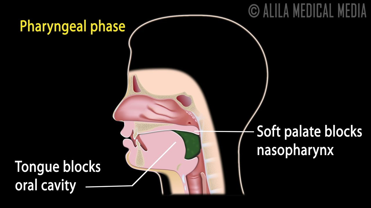 dysphagia diagrams