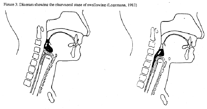 dysphagia diagrams