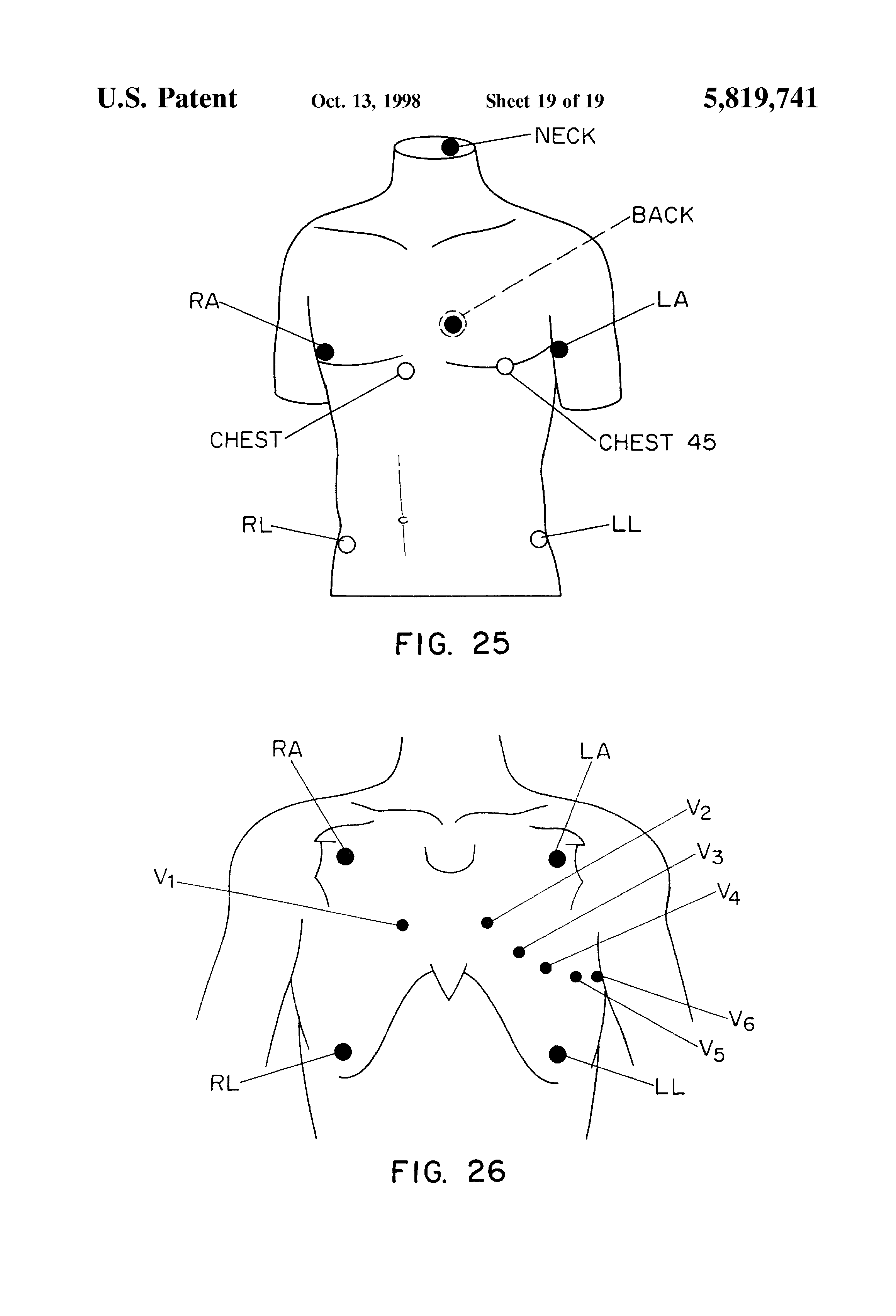 easi lead placement diagram