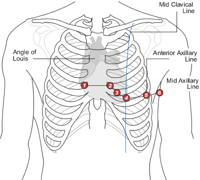 ecg electrode placement diagram