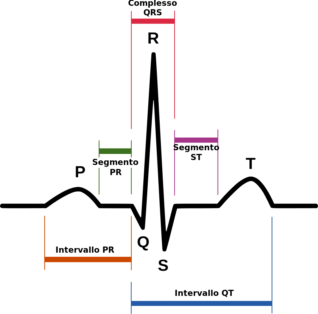 ecg electrode placement diagram