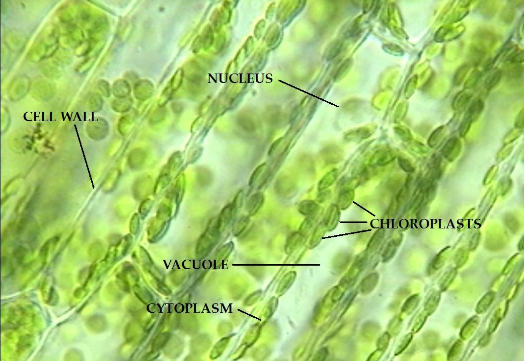 elodea leaf cell diagram