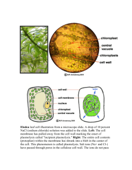 elodea leaf cell diagram