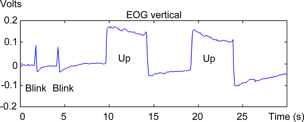 eog circuit diagram