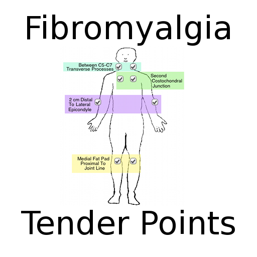 fibro tender points diagram