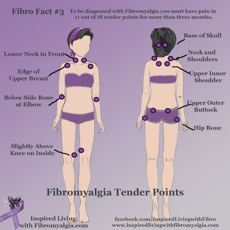 fibro tender points diagram