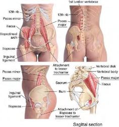 hip bursitis diagram