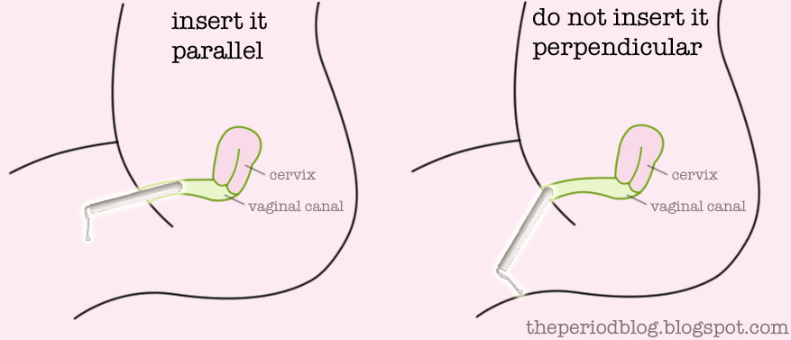 How To Insert Tampon Diagram.