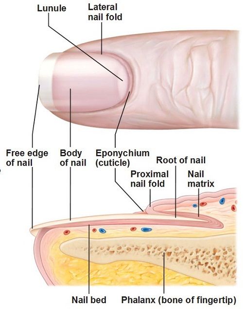 ingrown toenail diagram