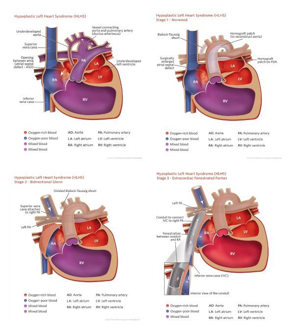 Kawashima Procedure Diagram Wiring Diagram Pictures