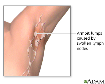 lymph nodes in armpit diagram