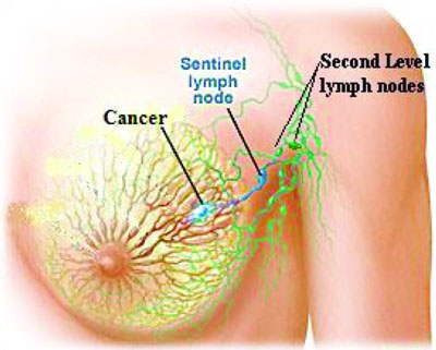 lymph nodes in armpit diagram