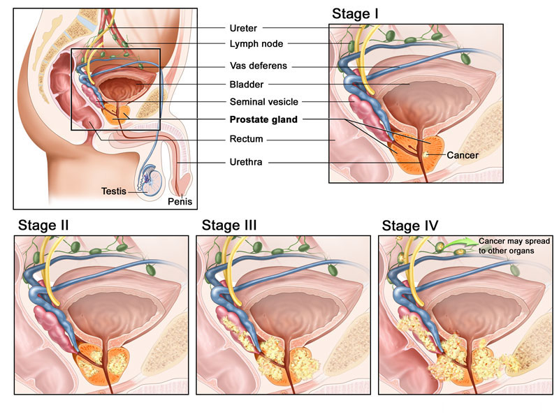 nuvaring diagram