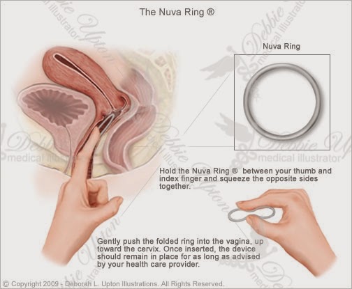 nuvaring diagram