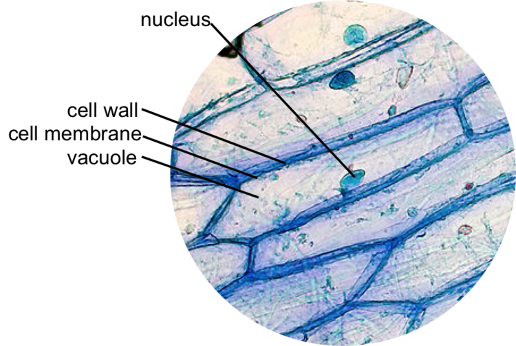onion epidermal cell diagram