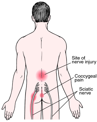 sciatic nerve path diagram
