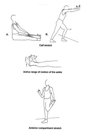 shin splints pictures diagrams