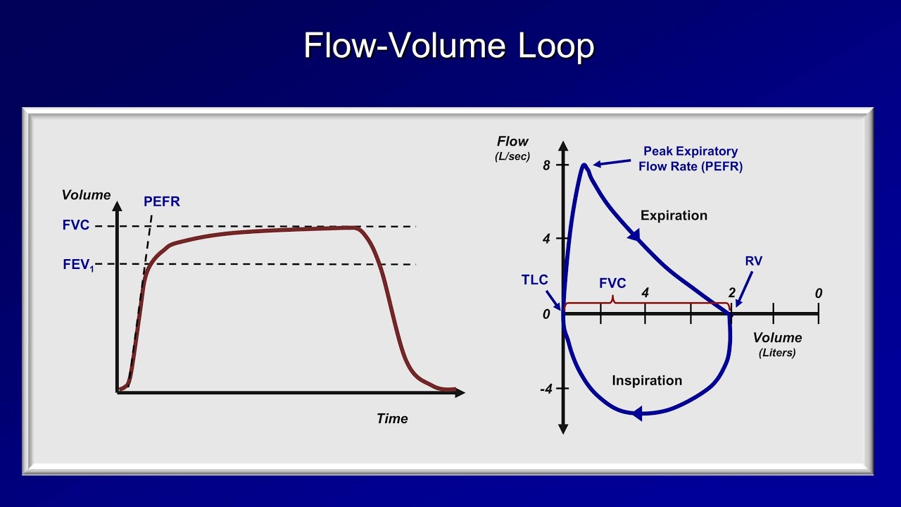 spirometry diagram