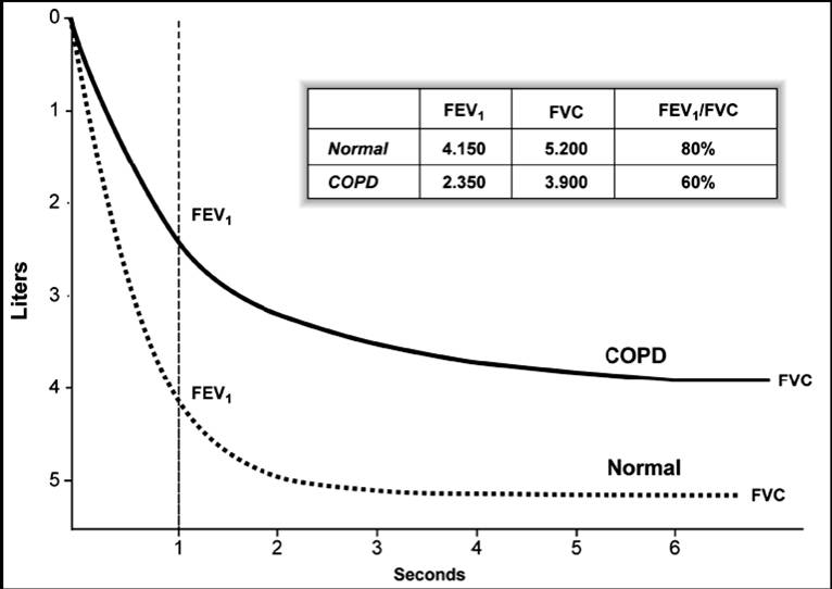 spirometry diagram