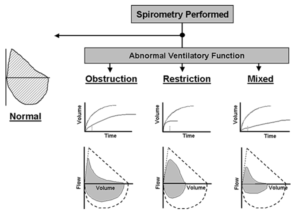 spirometry diagram