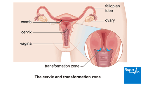 tilted cervix diagram