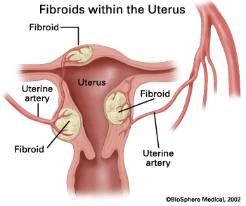 tilted cervix diagram