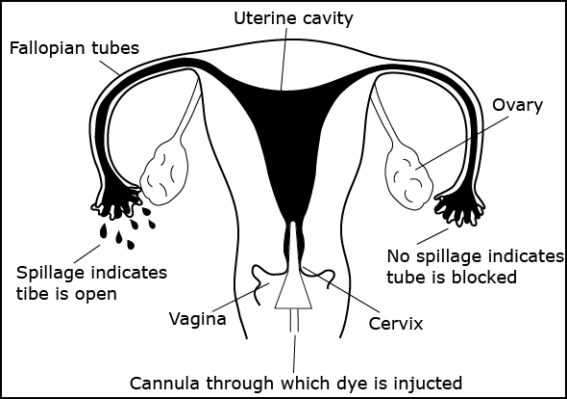 uterus fallopian tubes diagram