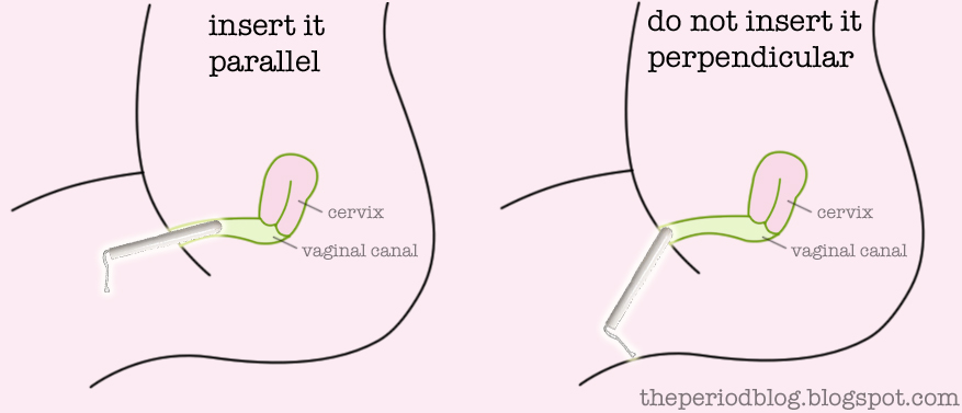what hole does the tampon go in diagram