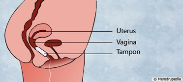 where to insert a tampon diagram