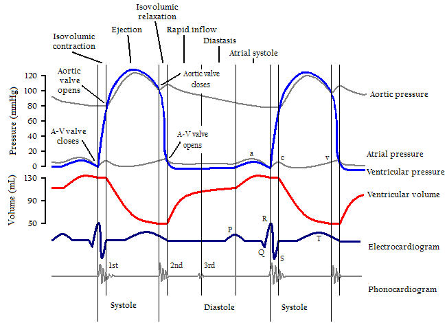 wigger diagram