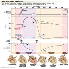 wigger diagram explained